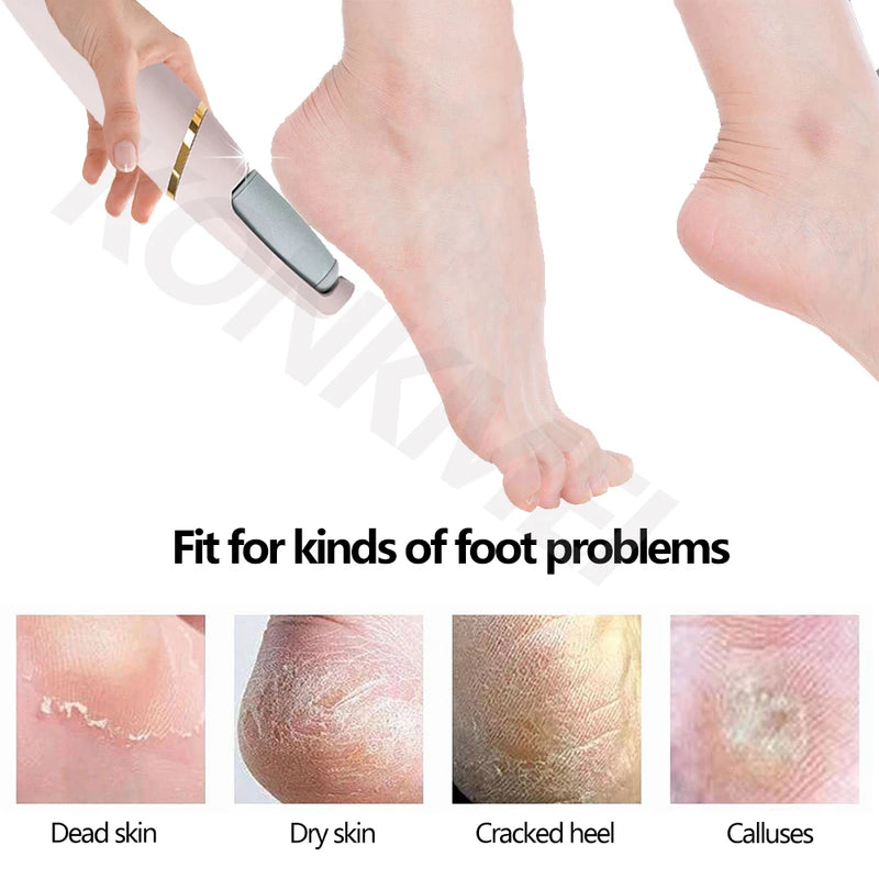 New Electric Pedicure Tool Film Foot Dead Skin Callus Remover Feet Exfoliator Pumice Stone for Heel Grinding Device For Gifts